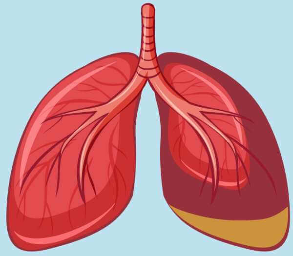 chimneys.com - mesothelioma